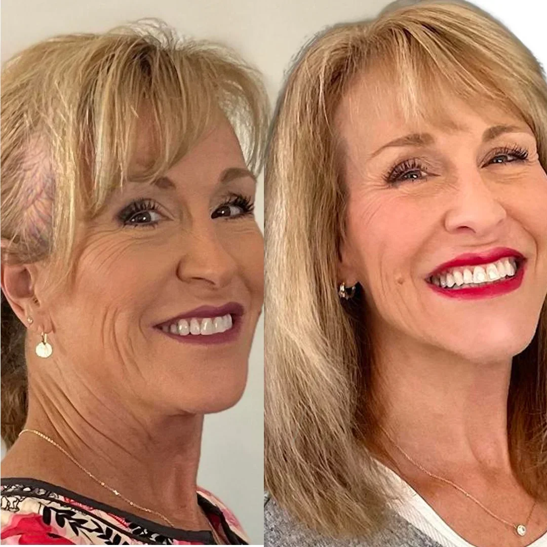 Bello Hair Helper Spray - 1-Month Supply