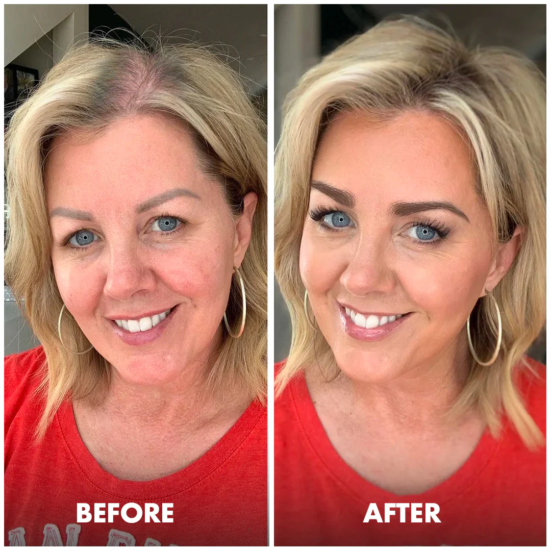 Trybello Biotin Spray 7 Trybello Biotin Spray