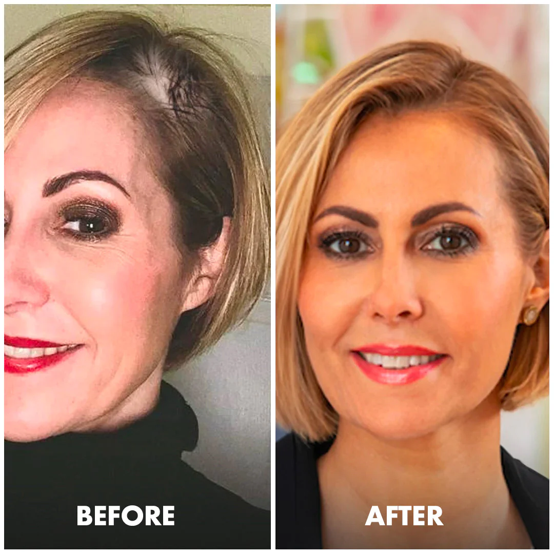 Bello Hair Helper Spray Sub 3 Bello Hair Helper Spray Sub