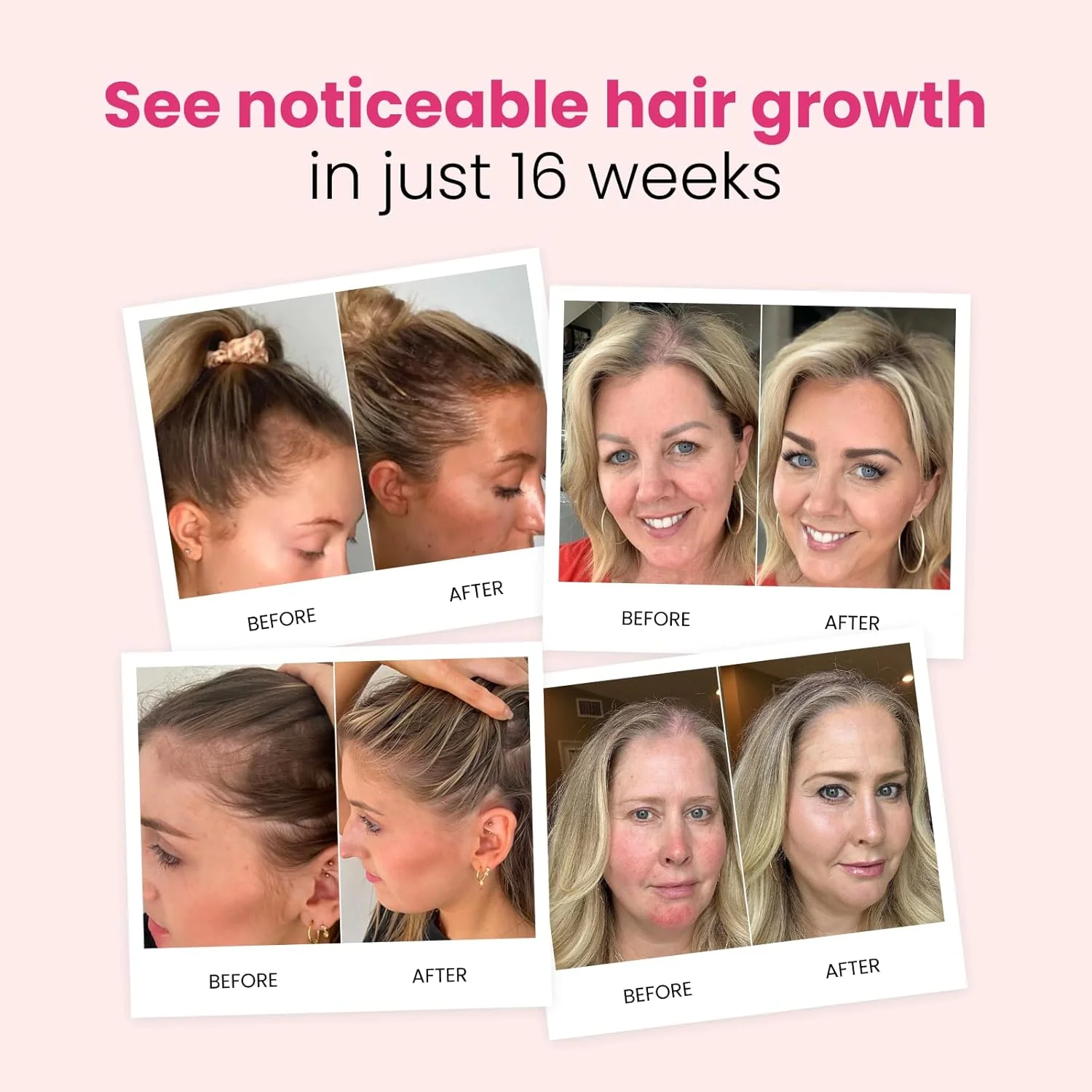 Bello Hair Growth Shampoo