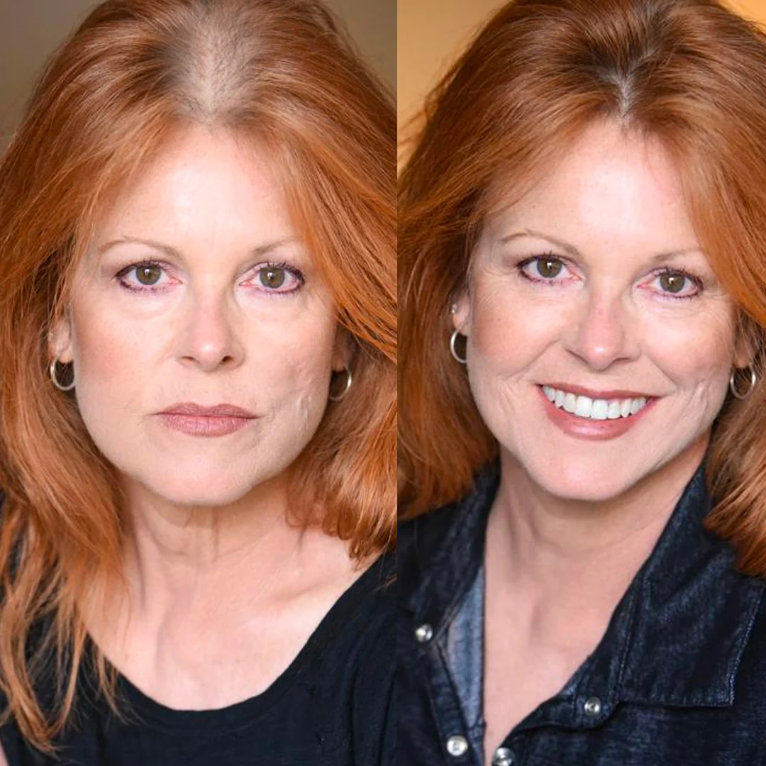 Hair Repair & Anti-Stress Gummies BOGO